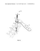 PEDICLE DRILL GUIDE FOR SPINAL SURGERY diagram and image