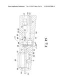 Apparatus and Method for Treating Disorders of the Ear, Nose and Throat diagram and image