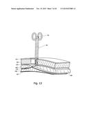 METHOD AND DEVICE FOR ULTRASOUND GUIDED MINIMAL INVASIVE ACCESS OF A     BODILY CAVITY diagram and image