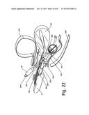 METHOD AND DEVICE FOR ULTRASOUND GUIDED MINIMAL INVASIVE ACCESS OF A     BODILY CAVITY diagram and image