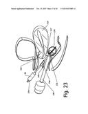 METHOD AND DEVICE FOR ULTRASOUND GUIDED MINIMAL INVASIVE ACCESS OF A     BODILY CAVITY diagram and image