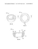 POLYAXIAL BONE ANCHOR HAVING AN OPEN RETAINER WITH CONICAL, CYLINDRICAL OR     CURVATE CAPTURE diagram and image