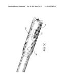 COMPOSITE MATERIAL BONE IMPLANT diagram and image