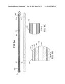 COMPOSITE MATERIAL BONE IMPLANT diagram and image