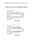 COMPOSITE MATERIAL BONE IMPLANT diagram and image