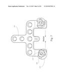 Occipital Plates with Mesh Portions diagram and image