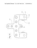 Occipital Plates with Mesh Portions diagram and image