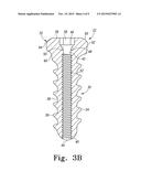 BONE SCREW diagram and image