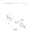 PLANAR FERROMAGNETIC COATED SURGICAL TIP AND METHOD FOR MAKING diagram and image