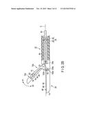 TREATMENT INSTRUMENT diagram and image