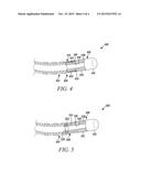 MECHANICAL VIBRATIONS ON RF ABLATION DEVICES diagram and image