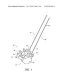 ROD CONTOURING ALIGNMENT LINKAGE diagram and image