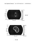 TREATMENT PLANNING FOR ELECTROPORATION-BASED THERAPIES diagram and image