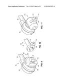 Telescopic Orthodontic Appliance diagram and image