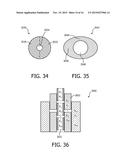 PLAQUE DETECTION USING A STREAM PROBE diagram and image