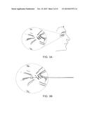 SOFT TISSUE AUGMENTATION THREADS AND METHODS OF USE THEREOF diagram and image