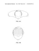 SOFT TISSUE AUGMENTATION THREADS AND METHODS OF USE THEREOF diagram and image