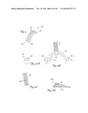 EMBOLIC PROTECTION DEVICES HAVING RADIOPAQUE ELEMENTS diagram and image