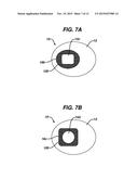 INJECTION ZONE MARKERS FOR BIOMEDICAL IMPLANTS diagram and image