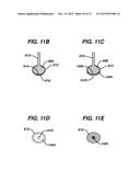 INJECTION ZONE MARKERS FOR BIOMEDICAL IMPLANTS diagram and image