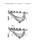 SOFT FILLED PROSTHESIS SHELL WITH VARIABLE TEXTURE diagram and image