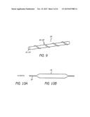 MINIMALLY INVASIVE TISSUE SUPPORT diagram and image