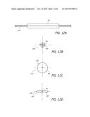 MINIMALLY INVASIVE TISSUE SUPPORT diagram and image