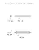 MINIMALLY INVASIVE TISSUE SUPPORT diagram and image