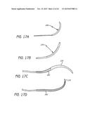 MINIMALLY INVASIVE TISSUE SUPPORT diagram and image