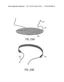 MINIMALLY INVASIVE TISSUE SUPPORT diagram and image