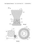 TRANSCATHETER VALVE WITH PARAVALVULAR LEAK SEALING RING diagram and image