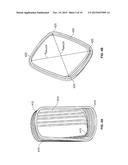 TRANSCATHETER VALVE WITH PARAVALVULAR LEAK SEALING RING diagram and image