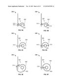 TRANSCATHETER VALVE WITH PARAVALVULAR LEAK SEALING RING diagram and image