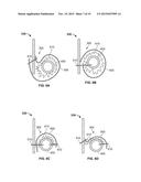 TRANSCATHETER VALVE WITH PARAVALVULAR LEAK SEALING RING diagram and image