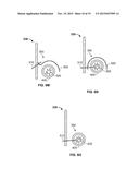 TRANSCATHETER VALVE WITH PARAVALVULAR LEAK SEALING RING diagram and image