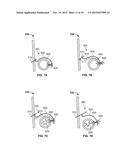 TRANSCATHETER VALVE WITH PARAVALVULAR LEAK SEALING RING diagram and image