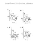 TRANSCATHETER VALVE WITH PARAVALVULAR LEAK SEALING RING diagram and image