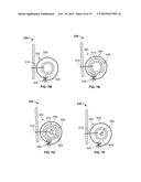 TRANSCATHETER VALVE WITH PARAVALVULAR LEAK SEALING RING diagram and image