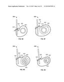 TRANSCATHETER VALVE WITH PARAVALVULAR LEAK SEALING RING diagram and image