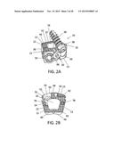 Standalone Interbody Implants diagram and image