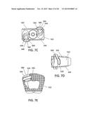 Standalone Interbody Implants diagram and image