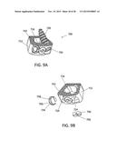 Standalone Interbody Implants diagram and image