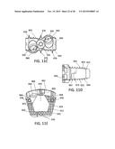 Standalone Interbody Implants diagram and image