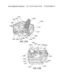 Standalone Interbody Implants diagram and image