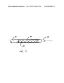 Endoprostheses and methods of manufacture diagram and image