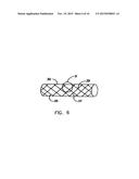 Endoprostheses and methods of manufacture diagram and image