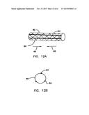 Endoprostheses and methods of manufacture diagram and image