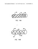 Endoprostheses and methods of manufacture diagram and image