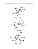 Endoprostheses and methods of manufacture diagram and image