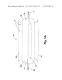 GASTRIC DEVICES, SYSTEMS, AND METHODS diagram and image